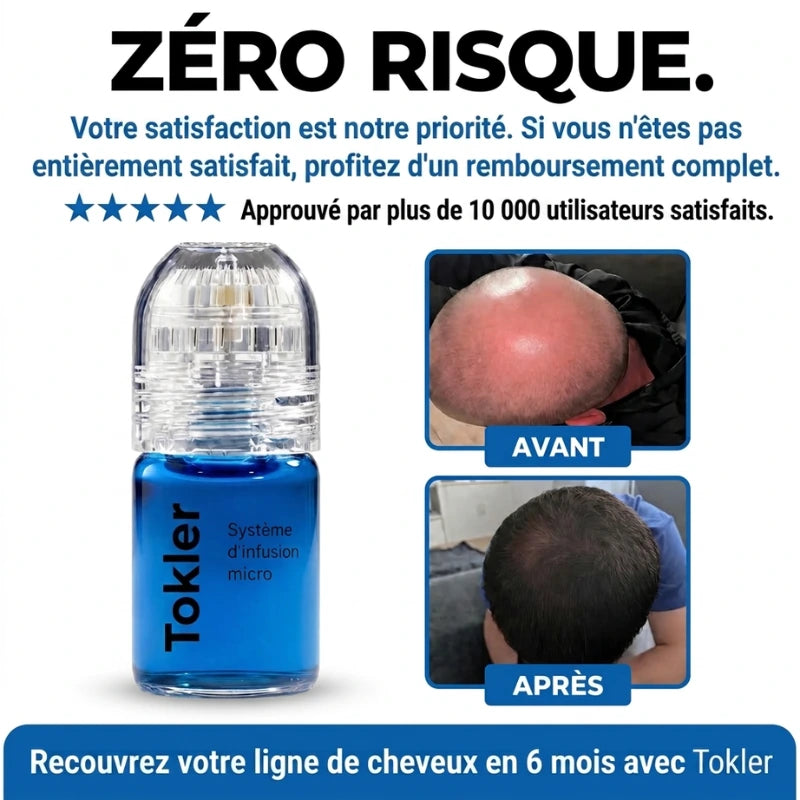 Le système de repousse capillaire par infusion de peptides le plus puissant