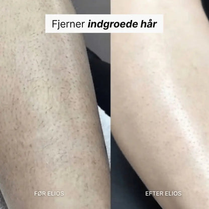 5-i-1 barbermaskine BRENF®