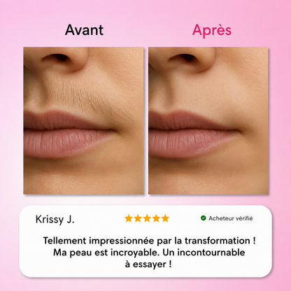 Kit Trilogie d’Épilation