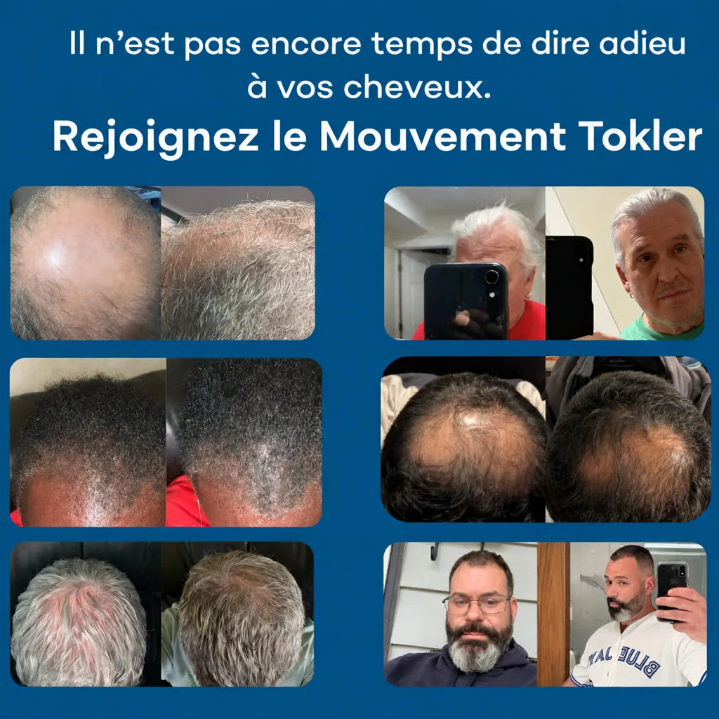 Le système de repousse capillaire par infusion de peptides le plus puissant