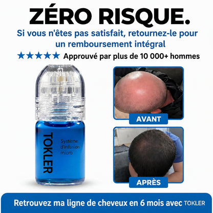 Le système de repousse capillaire par infusion de peptides le plus puissant