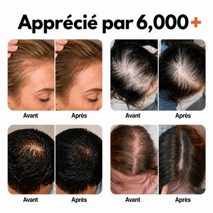 Le sérum de croissance capillaire n°1 en Corée
